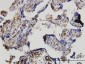 DKK1 Antibody (monoclonal) (M11)